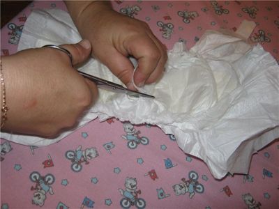 Аллергия у ребенка на памперсы